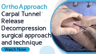 OrthoApproach - Carpal Tunnel Release/Decompression surgical approach and technique