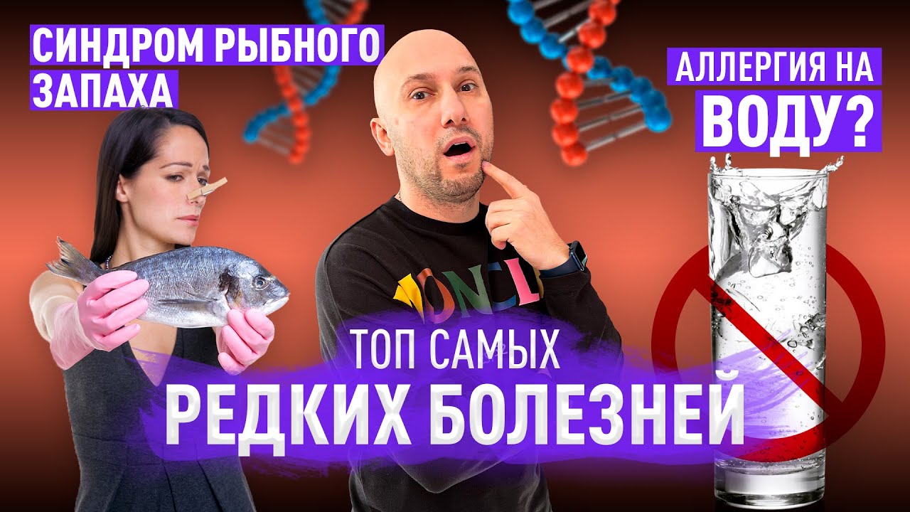 ТОП самых редких заболеваний в мире