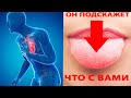 Страшные болезни, о которых расскажет вам ваш язык! Откуда берется налет на языке?