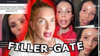 Healthyisch Momma Injects Cadaver Fat In Her Face In Order To Look More Healthy