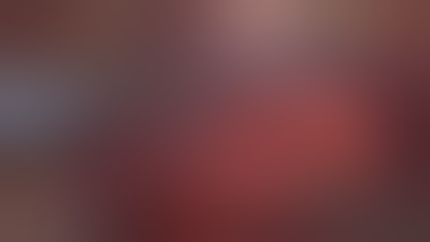 VATS Left Anterior (S3) Segmentectomy