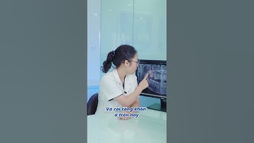 Niềng răng: Hết hóp má ( tăng hạng nhan sắc) | Lạc Việt Intech Niềng Răng #shorts