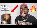 SHE SET MY HAIR ON FIRE!!!!