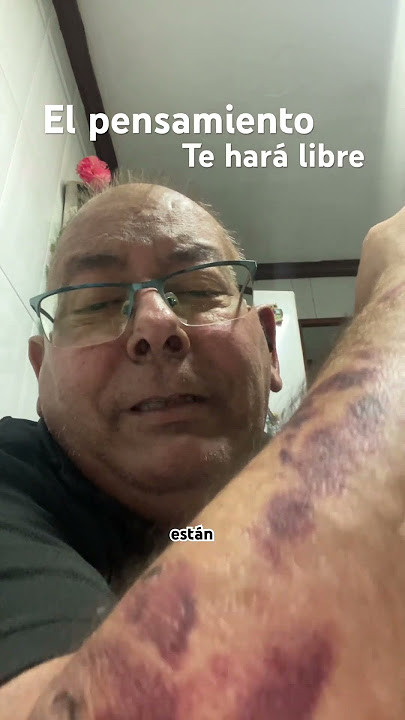Así luché contra el cáncer con mi mente