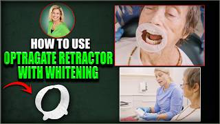 72 Years Young & Smiling Brighter! Amazing Before & After Teeth Whitening with VivaStyle