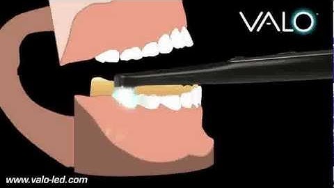 VALO Curing Light