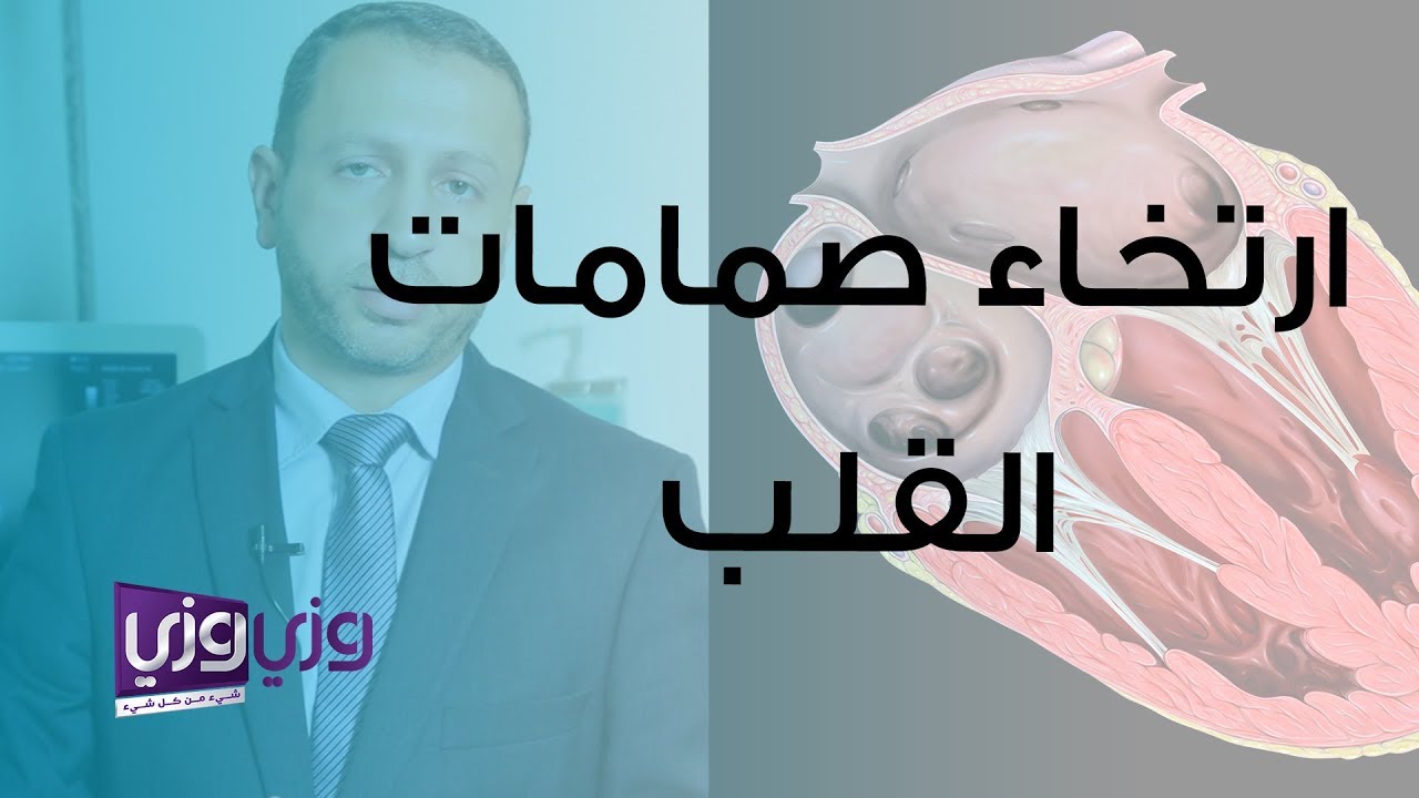 ارتخاء صمام القلب أو انسدال الصمام التاجي