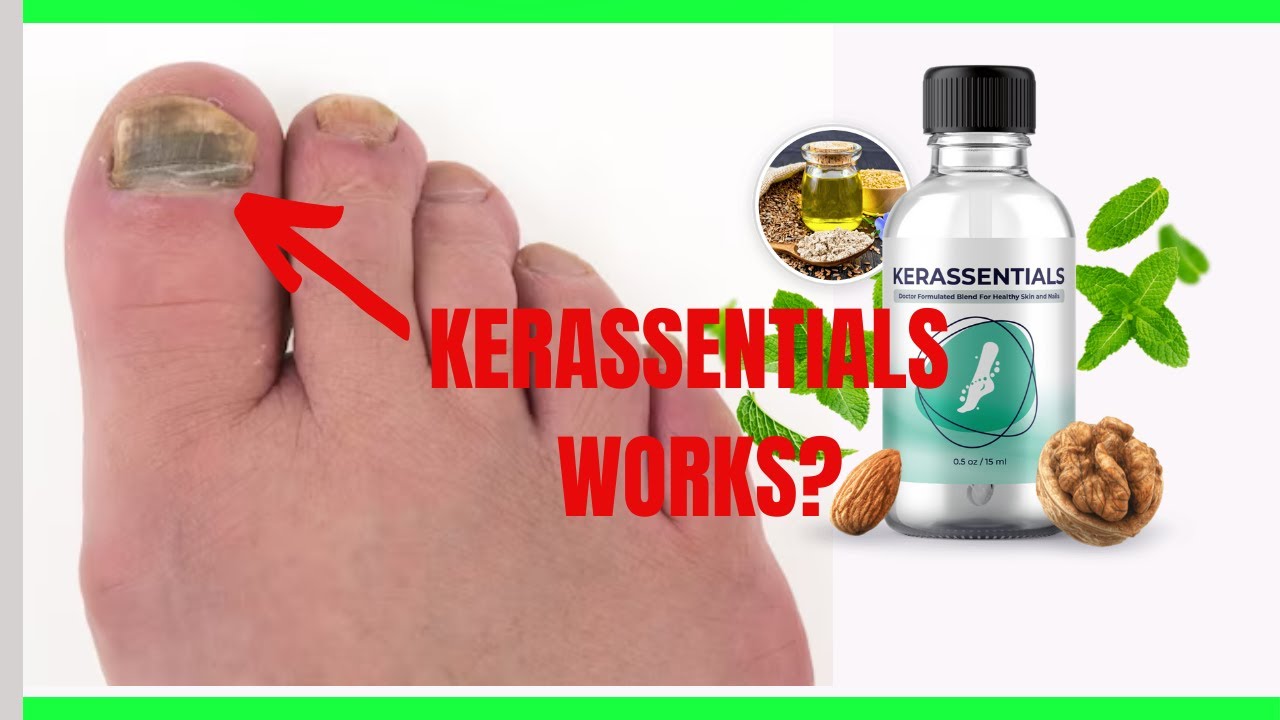 KERASSENTIALS REVIEW-KERASSENTIAS WORKS?