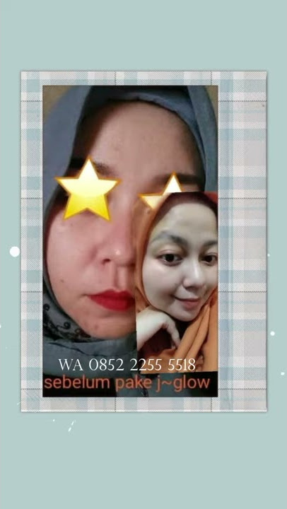 review testimoni j glow #testimonijglow #jglow #jglowskincare #jglowskin #skincarebpom