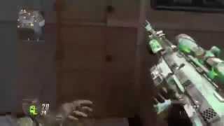 Deezey - Sick Private Match Shot Bo2