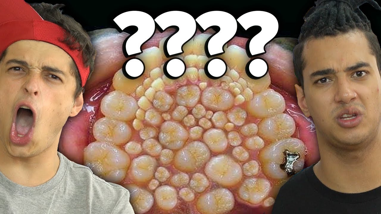 Quem Tem Agonia De Furos?