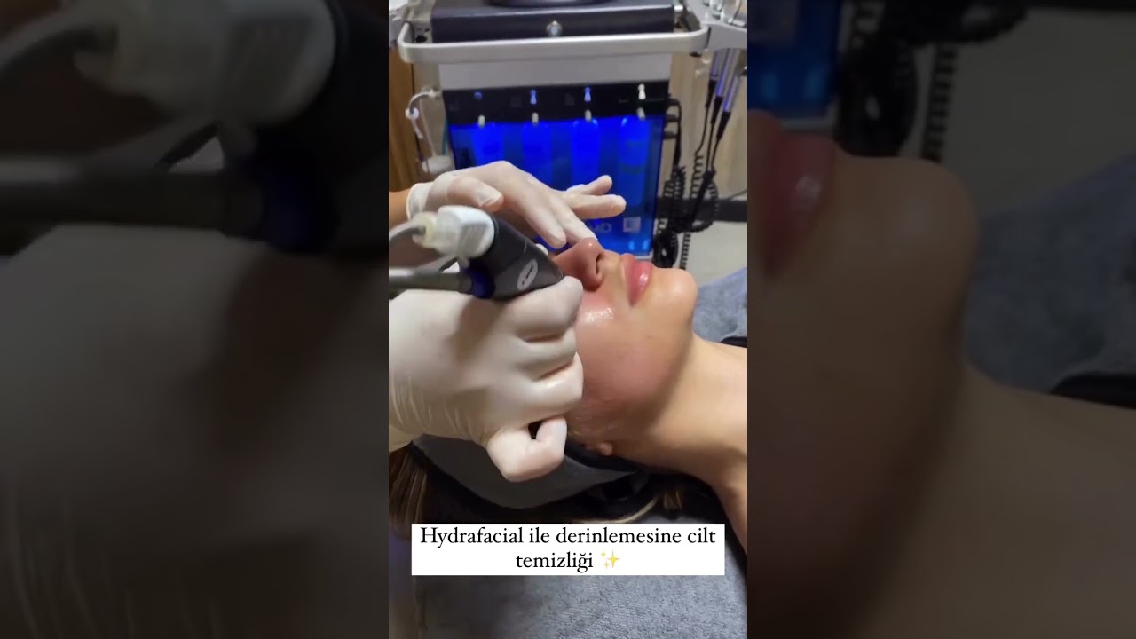 Hydrafacial ile derinlemesine temizlenmiş bir cilt✨