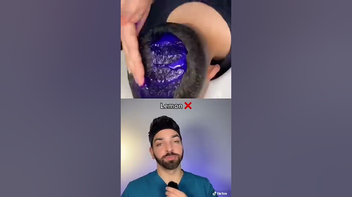 Doctor Reacts to Dandruff Hack | Doctorly #shorts