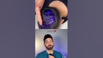 Thumbnail of Doctor Reacts to Dandruff Hack | Doctorly #shorts