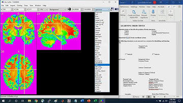 Intro to Brain Navigation with MRIcron Part1
