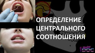 ОПРЕДЕЛЕНИЕ ЦЕНТРАЛЬНОГО СООТНОШЕНИЯ живая демонстрация