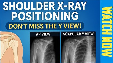"Shoulder X-ray Positioning | AP & Scapular Y View Explained with Tips 🔥"