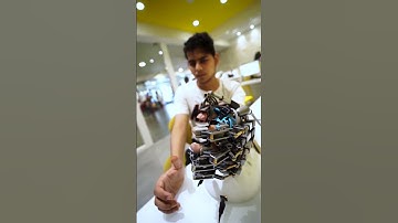 Best Neuro Physiotherapy & Rehab for Brain Tumor | Advanced Neuro Robotics | Inpatient Facillity