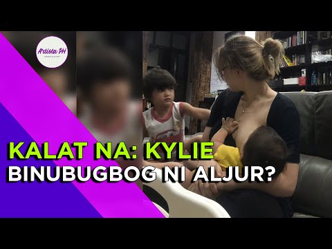 Video: Ang Mukha Ni Kylie Minogue Ay Nagiging Asymmetrical Dahil Sa Mga Tagapuno