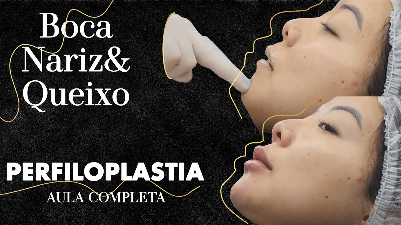 Perfiloplastia - Nariz, boca e queixo  - AULA COMPLETA