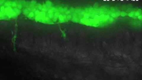 Olig2 GFP motor neuron projection