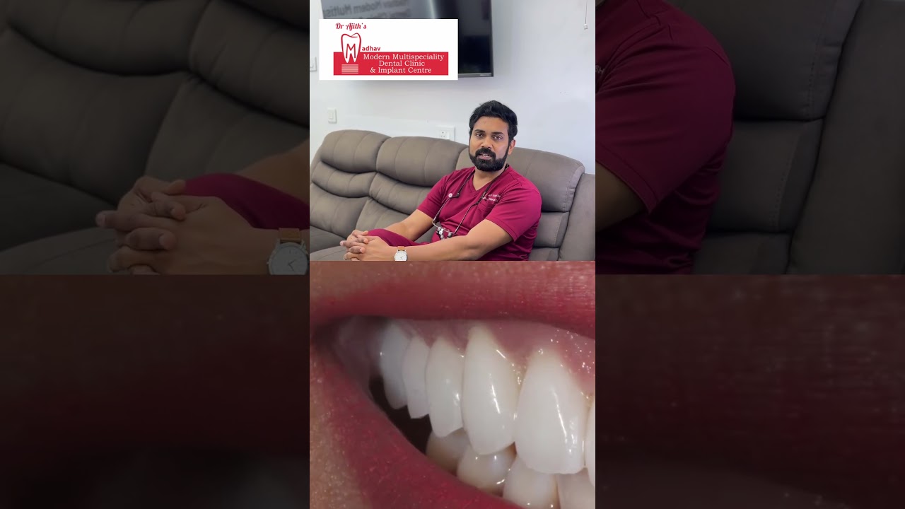 Dental Veneer YouTube thumbnail