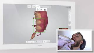 3DBioCAD - TRIOS Scan Strategy  - Quadrant