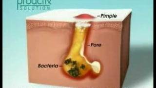 ProActive4