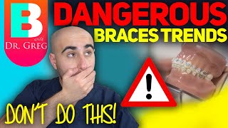 Dangerous Braces Trends **DON'T DO THIS**