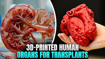 3D-Printed Human Organs For Transplants