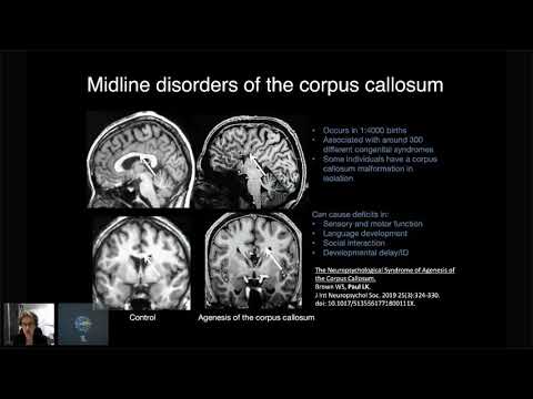 Molecular and activity-dependent mechanisms of cortical development underlying corpus callosum dysgenesis recording thumbnail