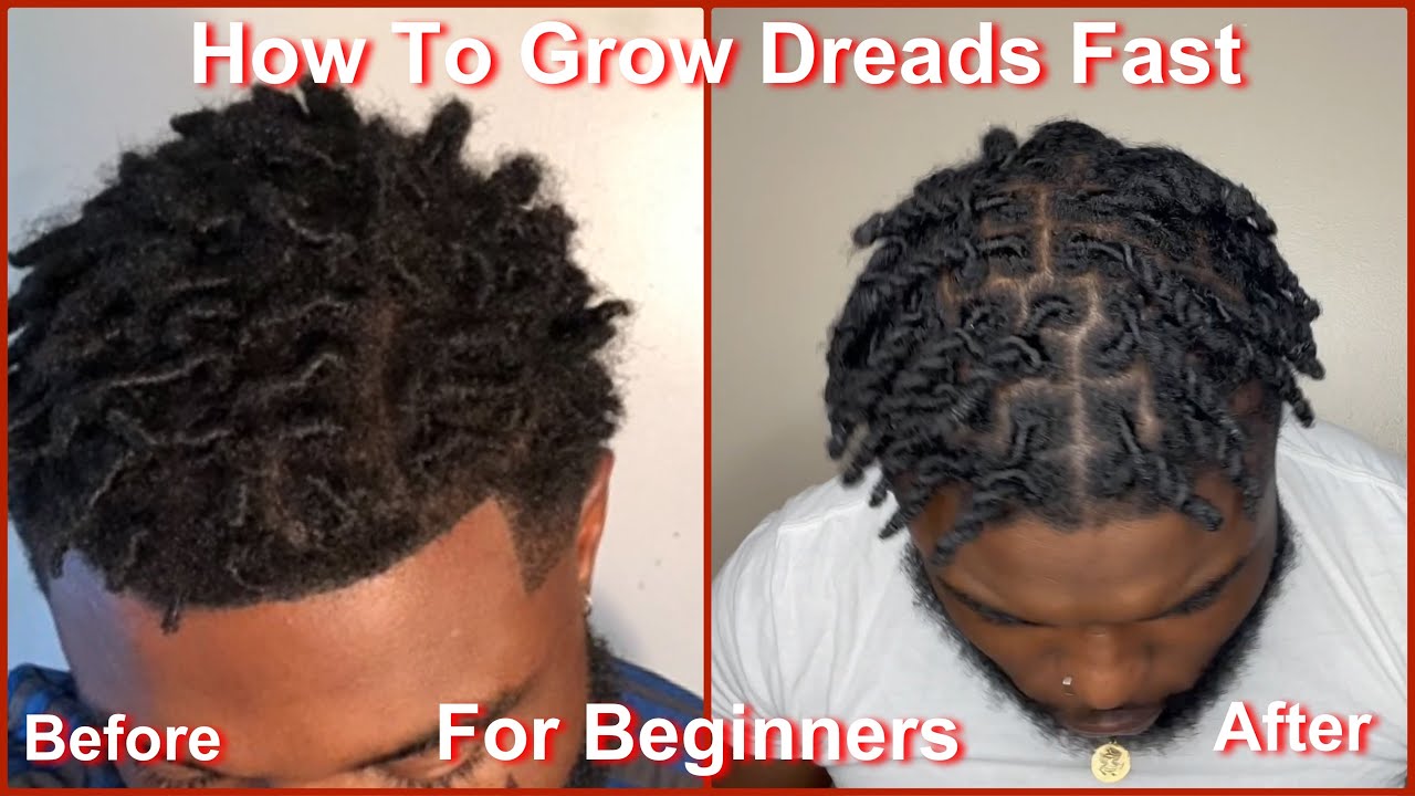 How To Grow Your Dreads Fast ! (Must watch before starting your locs