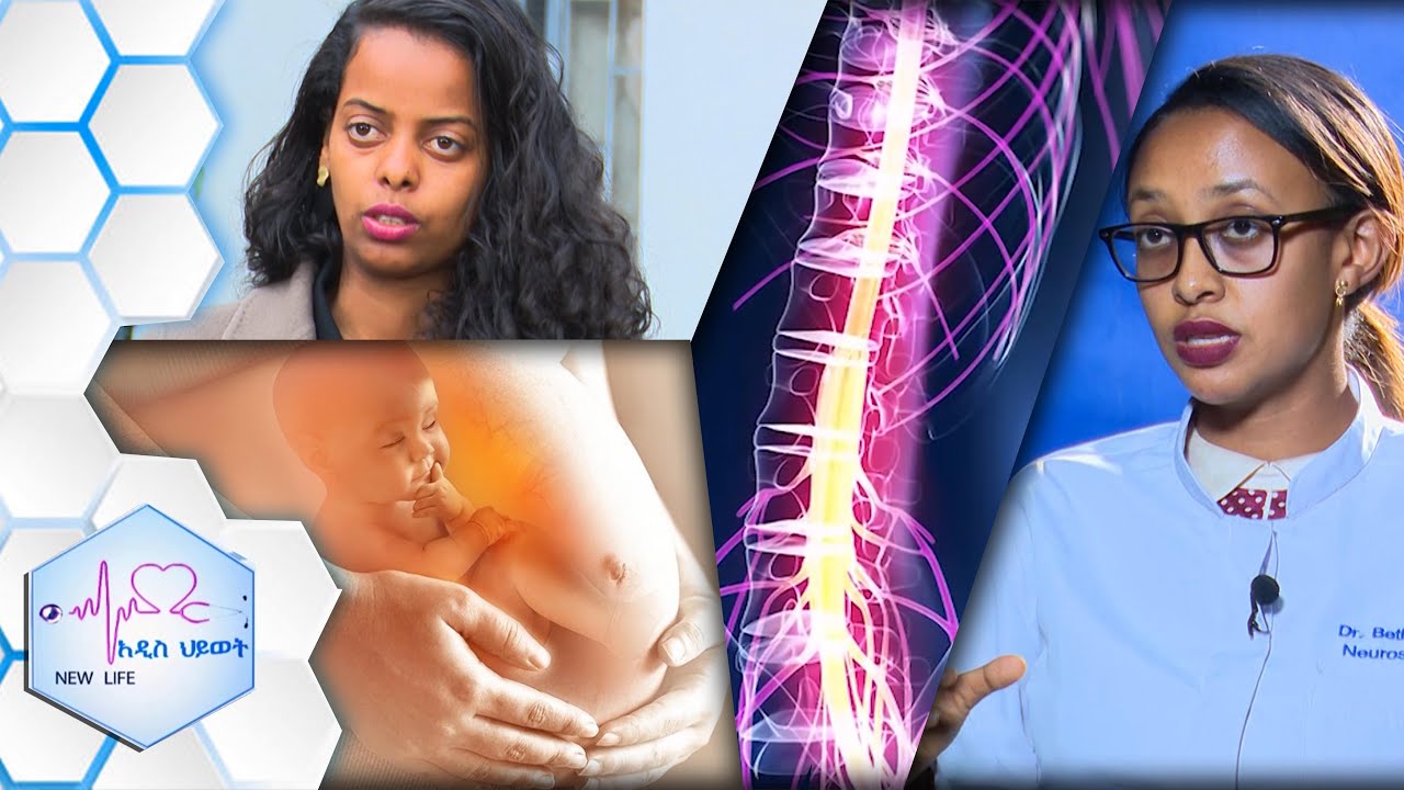 የዲስክ መንሸራተት እና ለእርጉዝ ጥሩ የሚባሉ ምግቦች /NEW LIFE EP 365