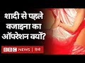 Vagina ऑपरेशन क्यों करा रही हैं Unmarried Girls, क्या इसका ताल्लुक Virginity से है?
