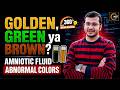 Amniotic Fluid Normal vs Abnormal Color & Function | 360° One Shot Series 🔥| Siddharth Sandu Sir