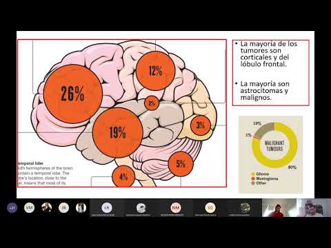 Vídeo: NKAP Altera El Microambiente Inmunitario Del Tumor Y Promueve El Crecimiento De Glioma A Través De La Señalización Notch1