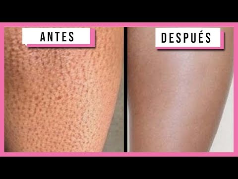 Video: Tobillos delgados: ¿alegría o problemas? Hermosas piernas - foto