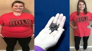 The fastest way to burn belly fat in 7 days without dieting and losing weightأسرع طريق حرق دهن البطن