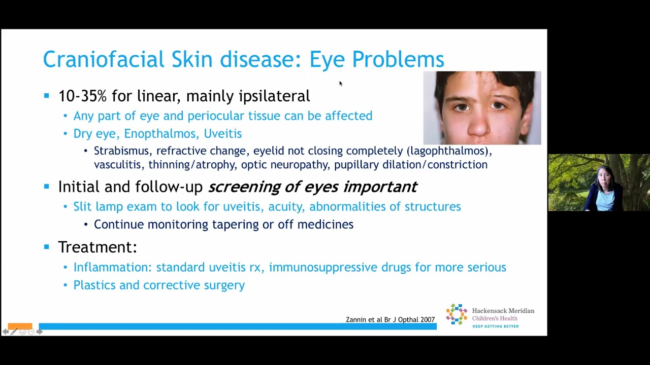 Common Complications in Juvenile Localized Scleroderma, General Health Guidelines