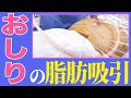 4100cc脂肪取れた女性。二の腕とふくらはぎで大変満足されたリピーター様の脂肪吸引に完全密着