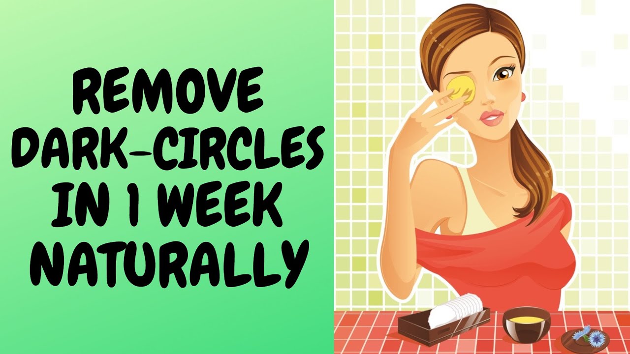 Home Remedies for DARK CIRCLES | Treat Dark Circles under Eyes