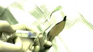 Lateral Cervical Epidural Anaesthesia