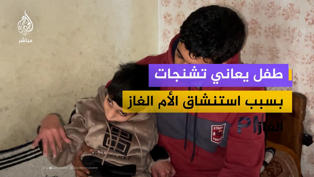 طفل يعاني تشنجات بسبب استنشاق أمه غاز الاحتلال أثناء حملها