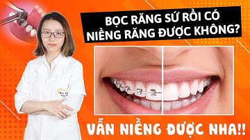 Răng bọc sứ rồi có niềng răng được không? Không phải ai cũng biết!