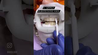 Zoom whitening procedure - one of the easiest ways to brightening your teeth! 🦷✨