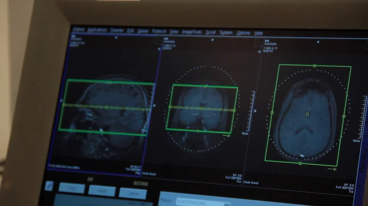How Scientists See the Differences in Liberal and Conservative Brains