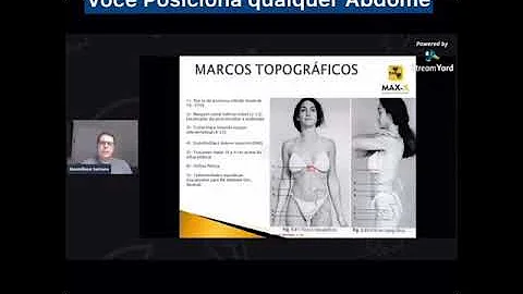 Como localizar o apêndice xifóide?