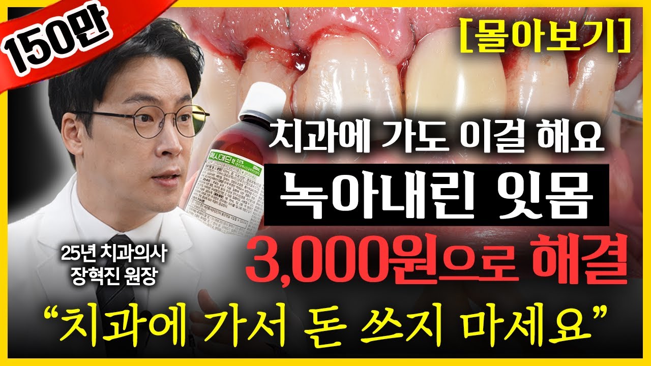 단돈 3천원으로 잇몸병 해결하는 법, 이대로 양치질 하세요! 평생 치과 갈 일 없습니다! 치석 사라지고 잇몸병 싹 낫습니다 l 치과 의사 장혁진