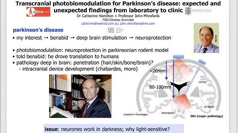 Brain photobiomodulation therapy a narrative review năm 2024