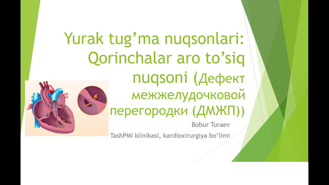 Tug'ma yurak nuqsoni. Qorinchalar aro to'siq nuqsoni (ДМЖП)